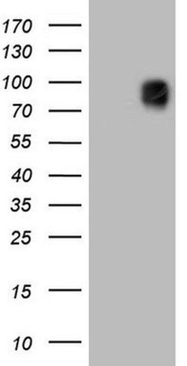 MCAM Antibody in Western Blot (WB)
