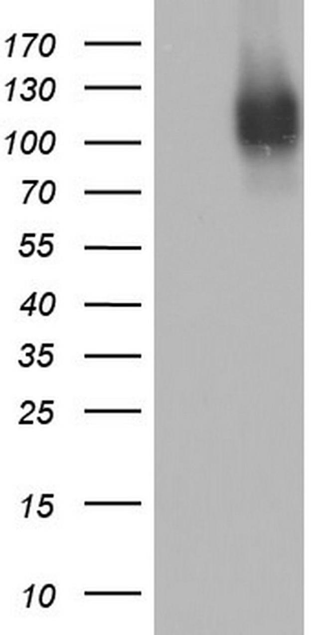 MCAM Antibody in Western Blot (WB)