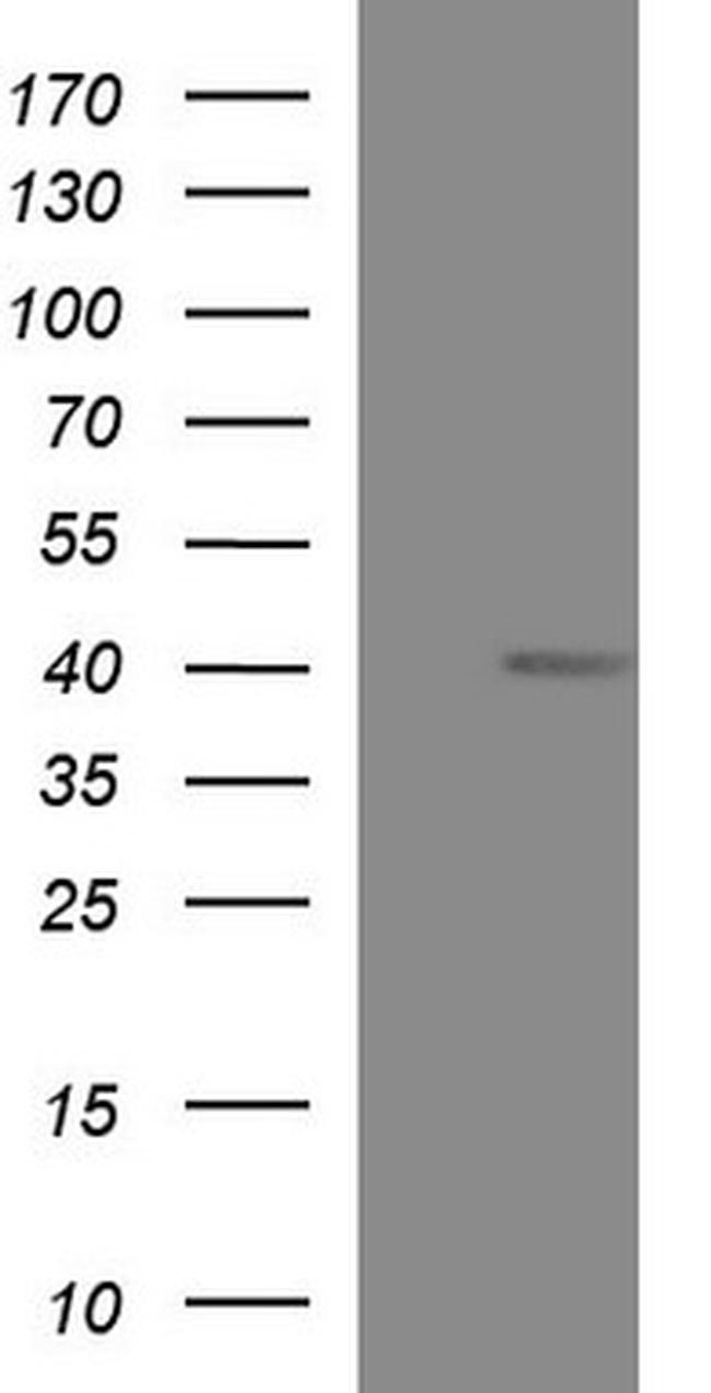 MCAT Antibody in Western Blot (WB)