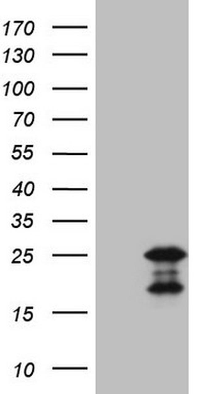 MCEE Antibody in Western Blot (WB)