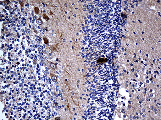 MCF2 Antibody in Immunohistochemistry (Paraffin) (IHC (P))