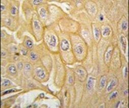 MCK10 Antibody in Immunohistochemistry (IHC)