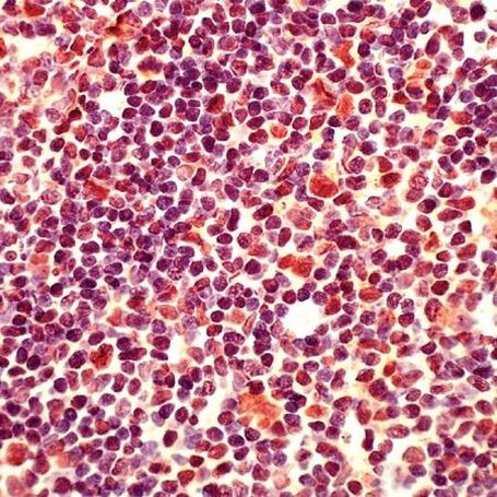 MCL1 Antibody in Immunohistochemistry (IHC)