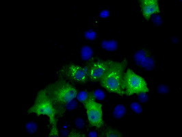 MCL1 Antibody in Immunocytochemistry (ICC/IF)