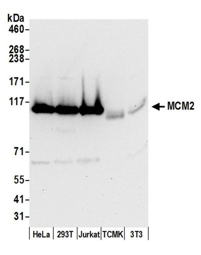 MCM2 Antibody in Western Blot (WB)