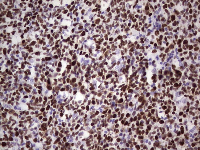 MCM2 Antibody in Immunohistochemistry (Paraffin) (IHC (P))