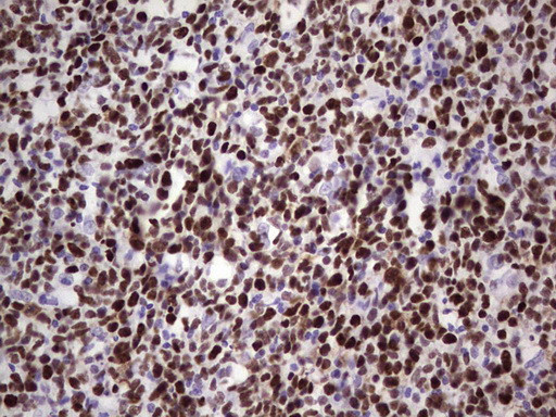 MCM2 Antibody in Immunohistochemistry (Paraffin) (IHC (P))
