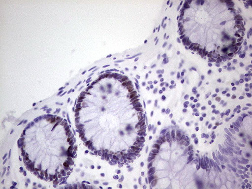 MCM2 Antibody in Immunohistochemistry (Paraffin) (IHC (P))