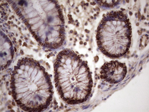 MCM2 Antibody in Immunohistochemistry (Paraffin) (IHC (P))