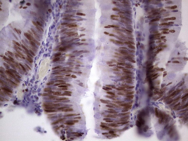 MCM2 Antibody in Immunohistochemistry (Paraffin) (IHC (P))