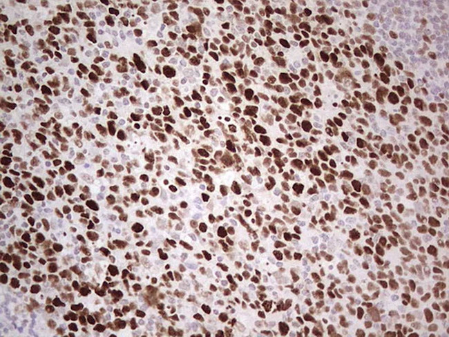 MCM2 Antibody in Immunohistochemistry (Paraffin) (IHC (P))