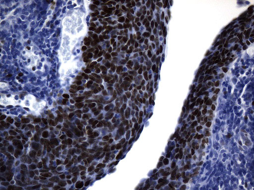 MCM2 Antibody in Immunohistochemistry (Paraffin) (IHC (P))