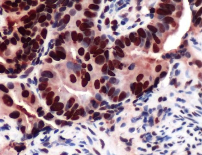 MCM2 Antibody in Immunohistochemistry (IHC)