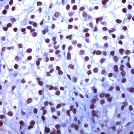 MCM5 Antibody in Immunohistochemistry (IHC)