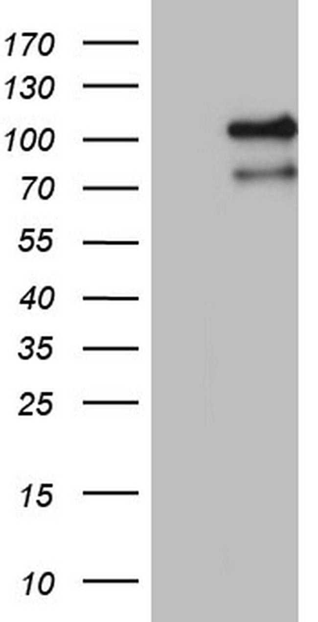 MCPH1 Antibody in Western Blot (WB)