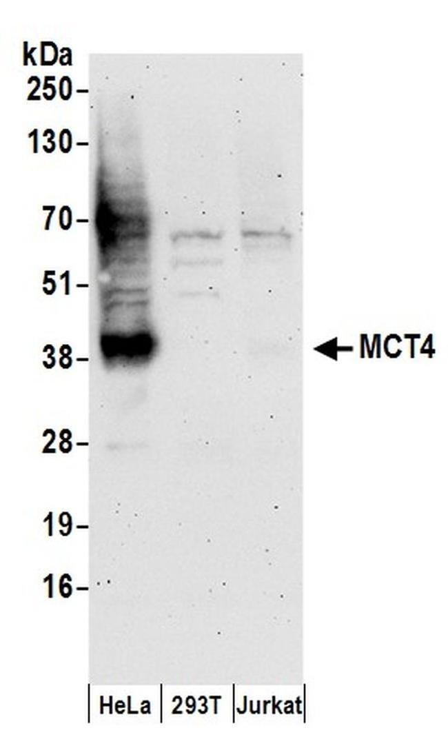 MCT4 Antibody in Western Blot (WB)