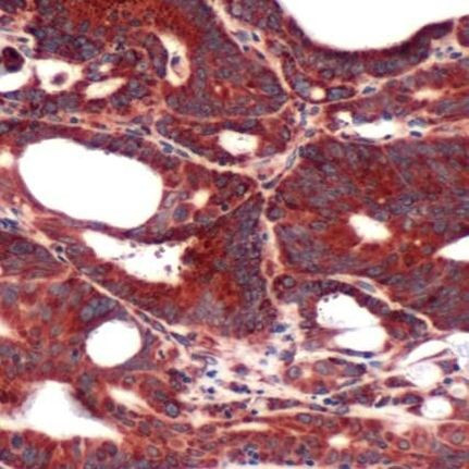 FABP3 Antibody in Immunohistochemistry (IHC)
