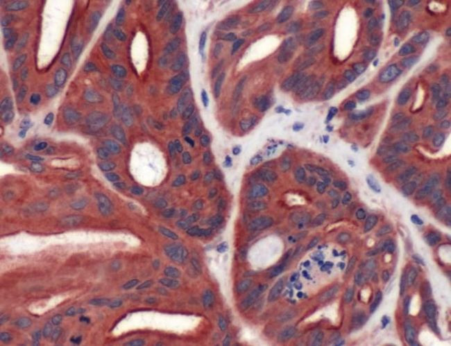 FABP3 Antibody in Immunohistochemistry (IHC)