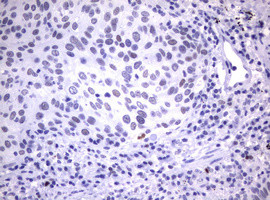MDM2 Antibody in Immunohistochemistry (Paraffin) (IHC (P))