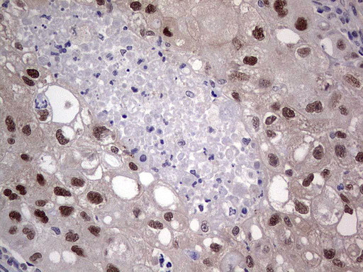 MDM2 Antibody in Immunohistochemistry (Paraffin) (IHC (P))