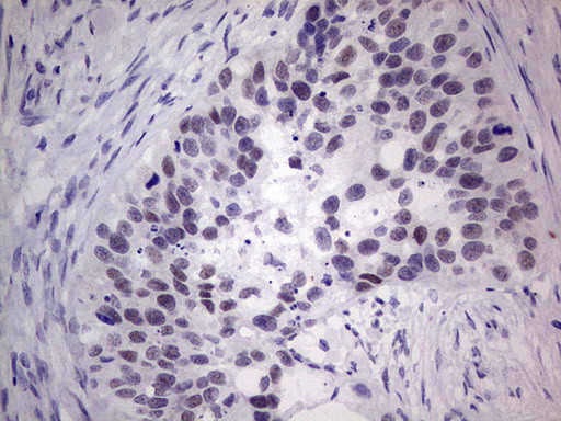 MDM2 Antibody in Immunohistochemistry (Paraffin) (IHC (P))