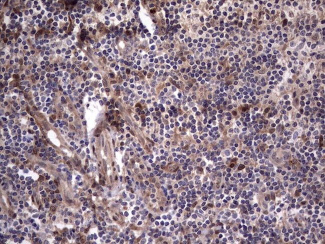MDM2 Antibody in Immunohistochemistry (Paraffin) (IHC (P))
