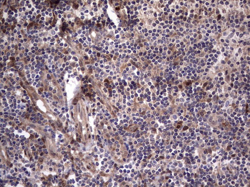 MDM2 Antibody in Immunohistochemistry (Paraffin) (IHC (P))