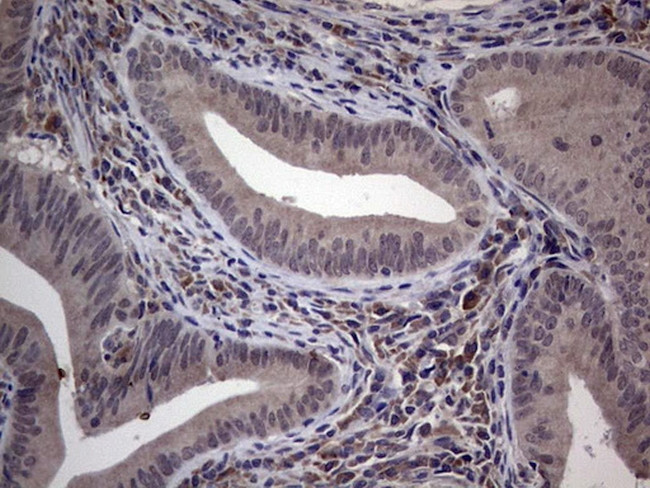 MDM2 Antibody in Immunohistochemistry (Paraffin) (IHC (P))