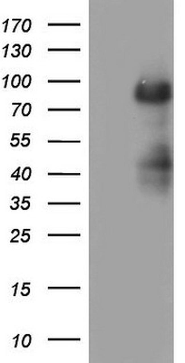 MDM2 Antibody in Western Blot (WB)