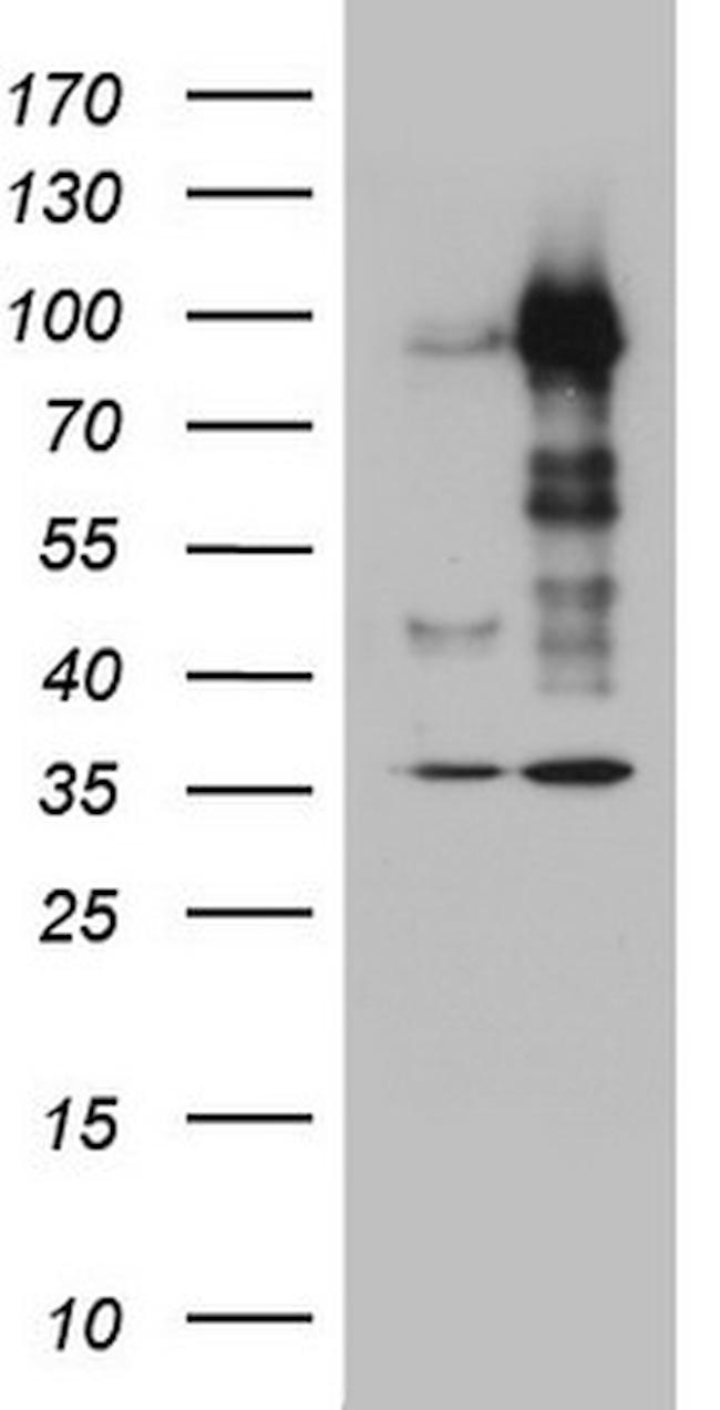 MDM2 Antibody in Western Blot (WB)