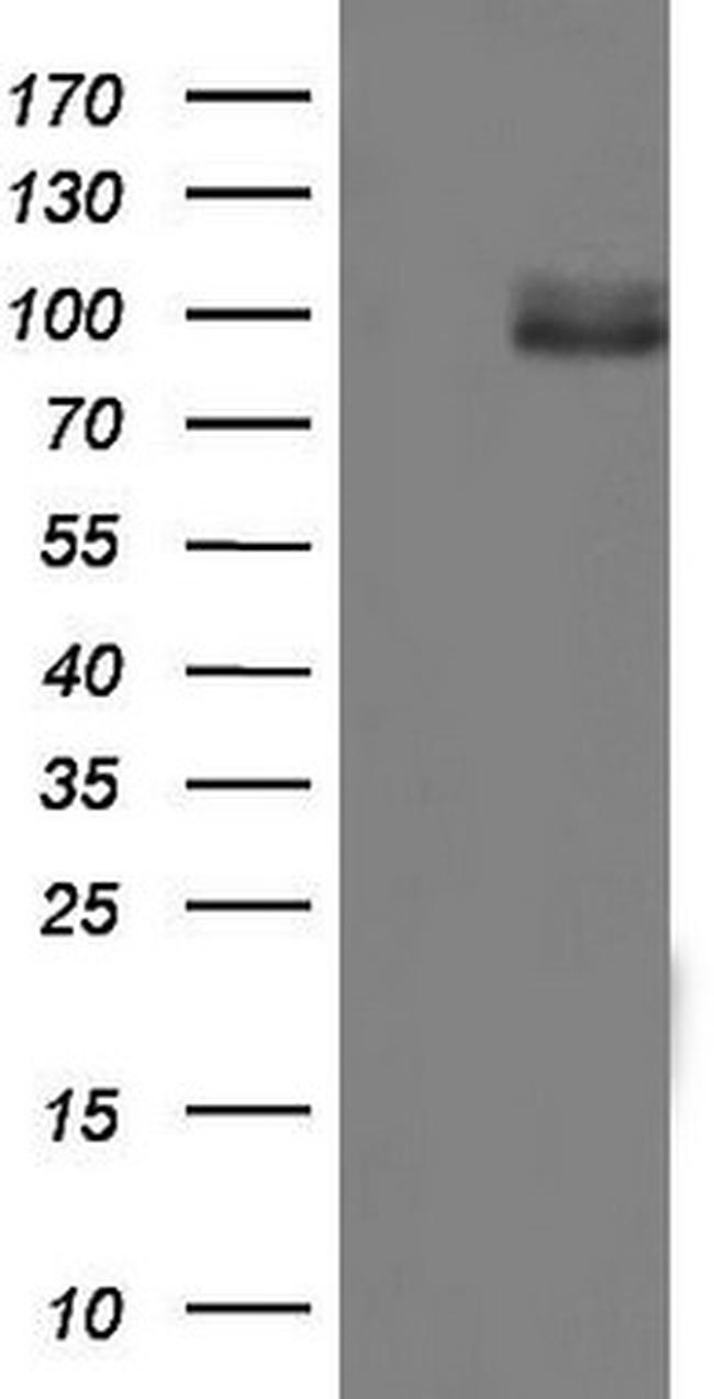 MDM2 Antibody in Western Blot (WB)