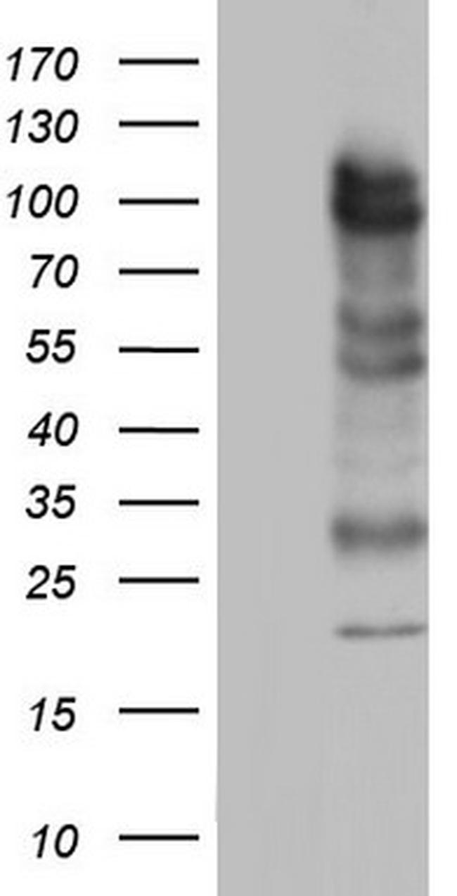 MDM2 Antibody in Western Blot (WB)
