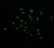 MDM4 Antibody in Immunocytochemistry (ICC/IF)
