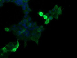 MDM4 Antibody in Immunocytochemistry (ICC/IF)