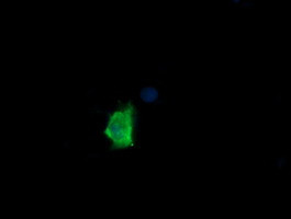 MDM4 Antibody in Immunocytochemistry (ICC/IF)