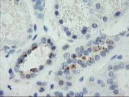 MDM4 Antibody in Immunohistochemistry (Paraffin) (IHC (P))