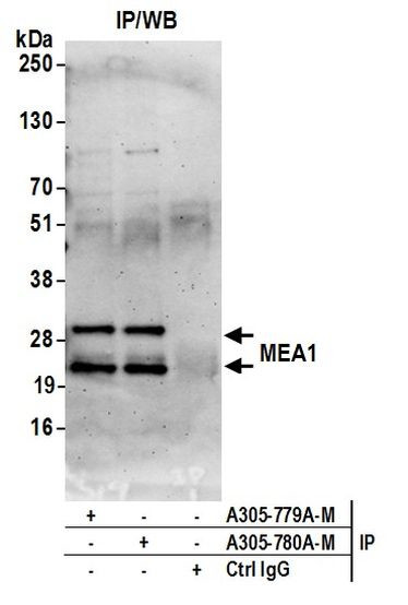 MEA1 Antibody in Immunoprecipitation (IP)