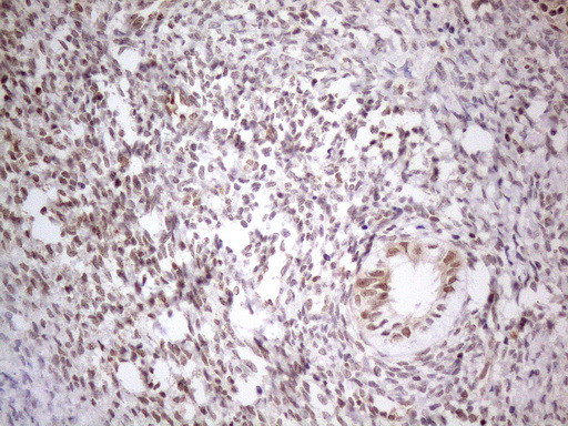 MED15 Antibody in Immunohistochemistry (Paraffin) (IHC (P))