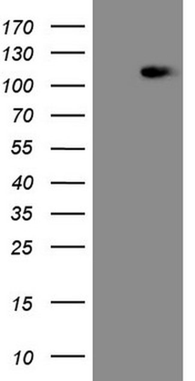 MED15 Antibody in Western Blot (WB)