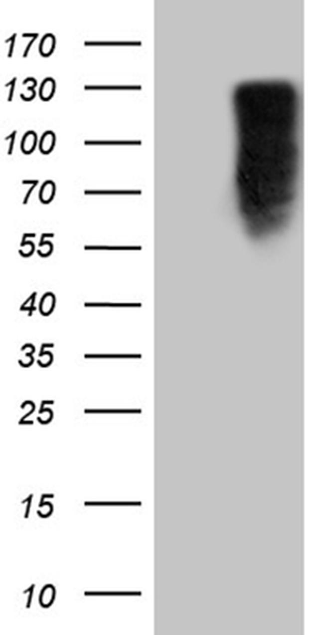 MED15 Antibody in Western Blot (WB)