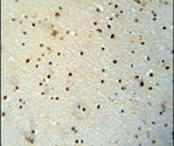 MED25 Antibody in Immunohistochemistry (IHC)