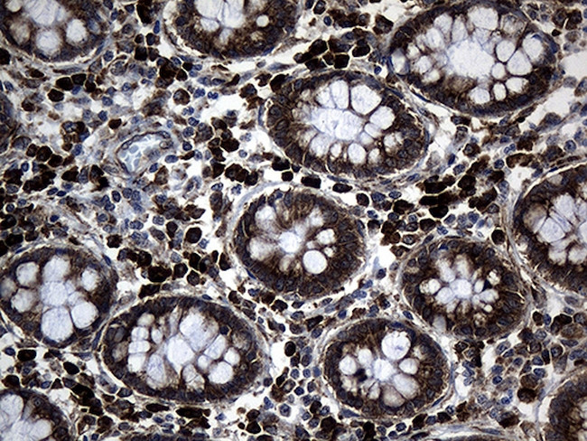 MED28 Antibody in Immunohistochemistry (Paraffin) (IHC (P))