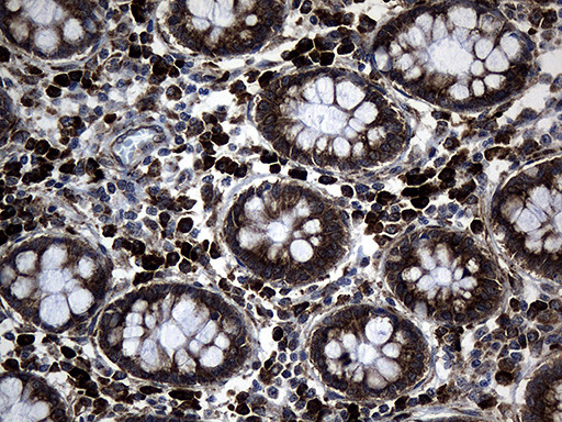 MED28 Antibody in Immunohistochemistry (Paraffin) (IHC (P))