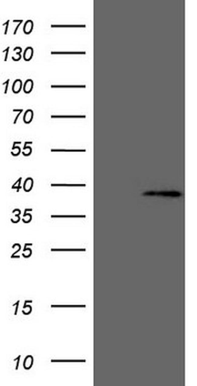MED6 Antibody in Western Blot (WB)