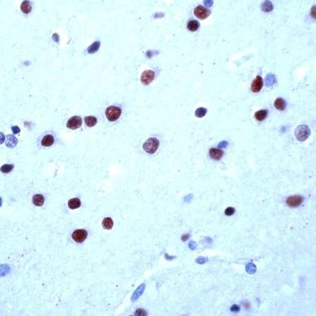 MEF2A Antibody in Immunohistochemistry (IHC)