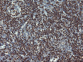 MEF2C Antibody in Immunohistochemistry (Paraffin) (IHC (P))