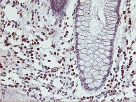 MEF2C Antibody in Immunohistochemistry (Paraffin) (IHC (P))