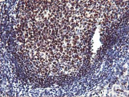 MEF2C Antibody in Immunohistochemistry (Paraffin) (IHC (P))