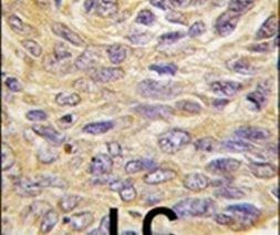 MEG2 Antibody in Immunohistochemistry (IHC)