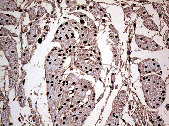 MEIS1 Antibody in Immunohistochemistry (Paraffin) (IHC (P))